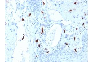 Formalin-fixed, paraffin-embedded human Tonsil stained with Tryptase Mouse Monoclonal Antibody (TPSAB1/1961). (TPSAB1 抗体  (AA 115-233))