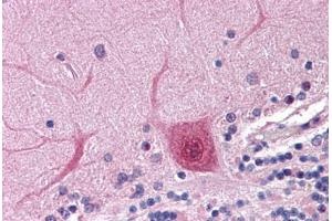 Human Brain, cerebellum: Formalin-Fixed, Paraffin-Embedded (FFPE) (ACTR2 抗体  (AA 40-311))