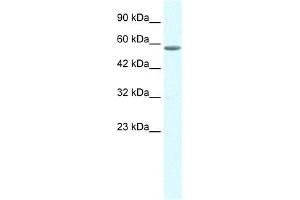 Western Blotting (WB) image for anti-General Transcription Factor IIE, Polypeptide 1, alpha 56kDa (GTF2E1) (C-Term) antibody (ABIN2792638)