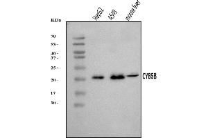 Western blot analysis of CYB5B using anti-CYB5B antibody (ABIN7600312).