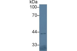 Western Blot; Sample: Mouse Heart lysate; Primary Ab: 3µg/ml Rabbit Anti-Mouse IL5Ra Antibody Second Ab: 0. (IL5RA 抗体  (AA 41-203))
