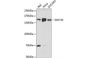 Western blot analysis of extracts of various cell lines using GM130 Polyclonal Antibody at dilution of 1:1000. (Golgin A2 (GOLGA2) 抗体)