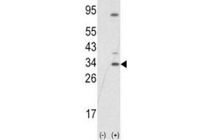 Western blot analysis of SNAI1 antibody and 293 cell lysate (2 ug/lane) either nontransfected (Lane 1) or transiently transfected with the SNAIL gene (2). (SNAIL 抗体  (AA 1-30))