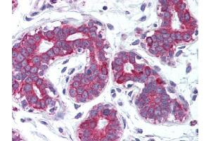 Image no. 1 for anti-Tumor Necrosis Factor (Ligand) Superfamily, Member 11 (TNFSF11) antibody (ABIN302887) (RANKL 抗体)