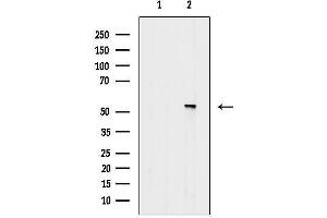 Western blot analysis of lysates from Rat heart, using Phospho-MAPKAPK5 (Thr182) Antibody.