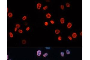 Immunofluorescence analysis of HeLa cells using p21 Polyclonal Antibody at dilution of 1:100. (p21 抗体)