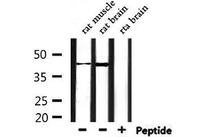 Western blot analysis of extracts from rat muscle and rat brain, using CHST14 Antibody. (CHST14 抗体  (Internal Region))