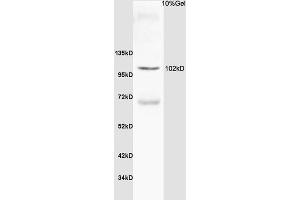 Rat thyroid lysate probed with Anti Thyroid peroxidase Polyclonal Antibody, Unconjugated (ABIN668736) at 1:200 overnight at 4 °C. (Thyroperoxidase 抗体  (AA 351-450))