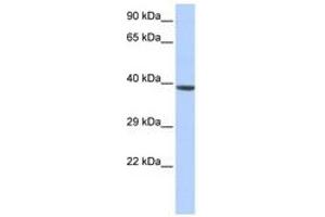 Image no. 1 for anti-Homeobox A2 (HOXA2) (C-Term) antibody (ABIN6740559) (HOXA2 抗体  (C-Term))