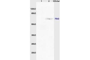 Lane 1: mouse intestine lysates Lane 2: mouse lung lysates probed with Anti TAP2/ABCB3 Polyclonal Antibody, Unconjugated (ABIN680123) at 1:200 in 4 °C. (TAP2 抗体  (AA 451-550))
