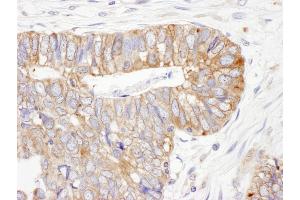 Immunohistochemistry (IHC) image for anti-Protein Disulfide Isomerase Family A, Member 6 (PDIA6) (AA 250-300) antibody (ABIN7453940) (PDIA6 抗体  (AA 250-300))