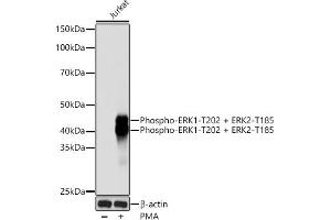 Western blot analysis of extracts of Jurkat cells, using Phospho-ERK1-T202 + ERK2-T185 Rabbit mAb (ABIN7268610) at 1:1000 dilution. (ERK1/2 抗体  (pThr185, pThr202))