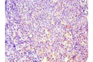 Immunohistochemistry (IHC) image for anti-Glucosidase, Beta, Acid 3 (Cytosolic) (GBA3) (AA 1-162) antibody (ABIN7149383)