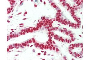 Anti-SMC1A / SMC1 antibody IHC staining of human breast.
