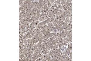 Immunohistochemical analysis of C on paraffin-embedded Human liver tissue. (Cyclin Y 抗体  (AA 140-169))