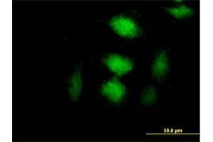 Immunofluorescence of purified MaxPab antibody to CLIC3 on HeLa cell. (CLIC3 抗体  (AA 1-236))