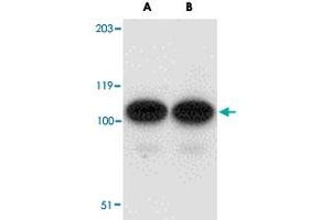 Western blot analysis of AFAP1L2 in human liver tissue lysate with AFAP1L2 polyclonal antibody  at (A) 1 and (B) 2 ug/mL . (AFAP1L2 抗体)