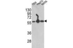 Western Blotting (WB) image for anti-Prolyl 4-Hydroxylase, beta Polypeptide (P4HB) antibody (ABIN3001707) (P4HB 抗体)