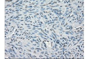 Immunohistochemical staining of paraffin-embedded Ovary tissue using anti-PPP5Cmouse monoclonal antibody. (PP5 抗体)
