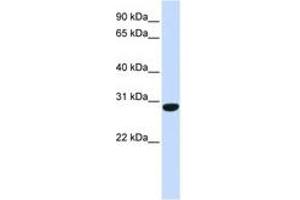 Image no. 1 for anti-Protein FAM164B (ZC2HC1B) (C-Term) antibody (ABIN6741093) (FAM164B 抗体  (C-Term))