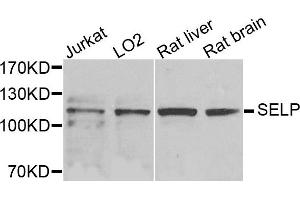 Western blot analysis of extracts of various cells, using SELP antibody. (P-Selectin 抗体)