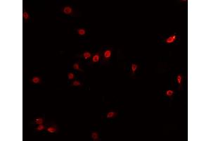 ABIN6266740 staining HeLa cells by IF/ICC. (Tspan-8 抗体  (Internal Region))