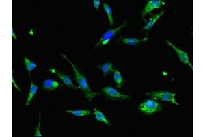 Immunofluorescent analysis of Hela cells using ABIN7144507 at dilution of 1:100 and Alexa Fluor 488-congugated AffiniPure Goat Anti-Rabbit IgG(H+L) (AQP2 抗体  (AA 225-271))