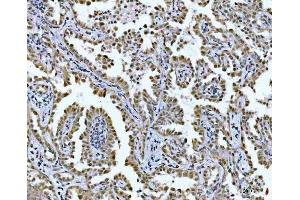 IHC analysis of GLIS1 using anti-GLIS1 antibody (ABIN7599501).