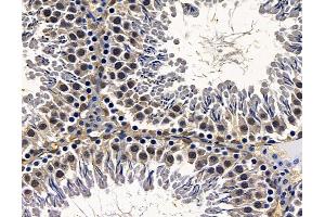 ABIN7095083 and ABIN7099139 at 1/100 staining rat testis tissue by IHC-P.