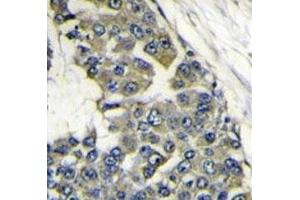 Immunohistochemistry (IHC) image for anti-Eukaryotic Translation Initiation Factor 4B (EIF4B) (AA 353-382) antibody (ABIN3028643)