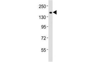 Western blot testing of Tet1 antibody at 1:2000 dilution + F9 lysate (TET1 抗体  (C-Term))
