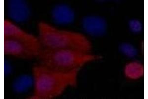 Immunofluorescence analysis of 293 cells transfected with a His tag protein tissue using His-Tag Monoclonal Antibody at dilution of 1:1000. (His Tag 抗体)