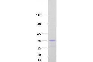 Western Blotting (WB) image for C-Type Lectin Domain Family 2, Member D (CLEC2D) (Transcript Variant 2) protein (Myc-DYKDDDDK Tag) (ABIN2712865)