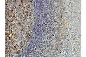 Immunostaining (ISt) image for anti-Proteasome (Prosome, Macropain) 26S Subunit, Non-ATPase, 10 (PSMD10) (AA 127-226) antibody (ABIN562495)
