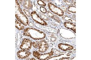 Immunohistochemical staining of human kidney with TTLL8 polyclonal antibody  shows distinct cytoplasmic positivity in cells in tubules at 1:200-1:500 dilution.