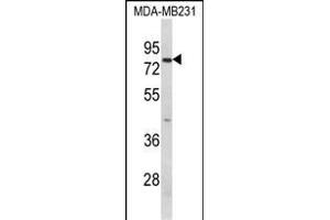 Western blot analysis of RANBP9 Antibody (Center) (ABIN652440 and ABIN2842299) in MDA-M cell line lysates (35 μg/lane). (Importin 9 抗体  (AA 339-367))