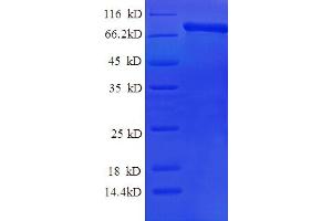 SDS-PAGE (SDS) image for Calpain 2 (CAPN2) (AA 20-700) protein (His tag) (ABIN5709191) (Calpain 2 Protein (CAPN2) (AA 20-700) (His tag))