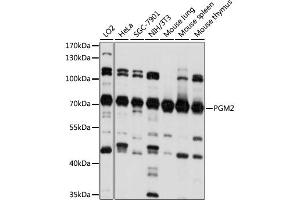 Western blot analysis of extracts of various cell lines, using PGM2 antibody. (Phosphoglucomutase 2 抗体)