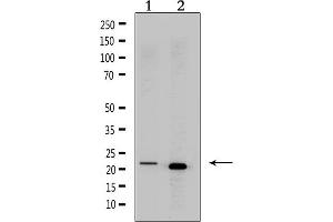 Western Blotting (WB) image for anti-Corticotropin Releasing Hormone (CRH) (N-Term) antibody (ABIN6261032)