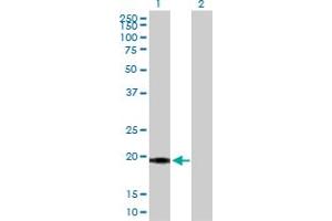 Western Blot analysis of SELS expression in transfected 293T cell line by SELS MaxPab polyclonal antibody. (Selenoprotein S 抗体  (AA 1-187))