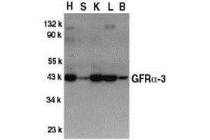 Western blot analysis of GFR alpha 3 in crude cell membrane fractions of mouse heart (H), spleen (S), kidney (K), liver (L), and brain (B), respectively, with AP30363PU-N GFR alpha 3 antibody at 1/500 dilution. (GFRA3 抗体  (Intermediate Domain))