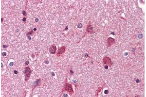 Human Brain, cortex: Formalin-Fixed, Paraffin-Embedded (FFPE) (AGPS 抗体  (AA 370-628))