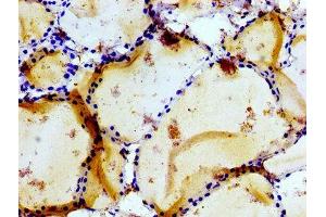 Immunohistochemistry of paraffin-embedded human thyroid tissue using ABIN7153969 at dilution of 1:100 (GRIK1 抗体  (AA 675-834))