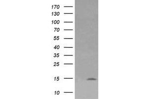 Image no. 1 for anti-Lysozyme (LYZ) antibody (ABIN1499236) (LYZ 抗体)