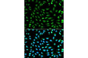 Immunofluorescence analysis of A549 cell using PCNA antibody. (PCNA 抗体  (AA 1-261))