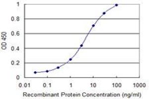 Detection limit for recombinant GST tagged SIRT1 is 0. (SIRT1 抗体  (AA 456-555))