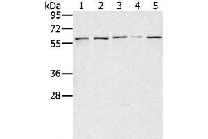 Western Blot analysis of Lovo, hela, K562, Raji and hepg2 cell using SESN1 Polyclonal Antibody at dilution of 1:200 (SESN1 抗体)