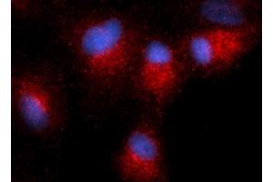 Immunofluorescence (IF) image for anti-Centromere Protein B (CENPB) antibody (PE) (ABIN5567026) (CENPB 抗体  (PE))