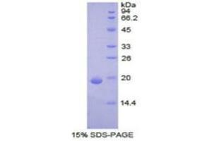 SDS-PAGE (SDS) image for Keratin 9 (KRT9) (AA 315-456) protein (His tag) (ABIN1878198)