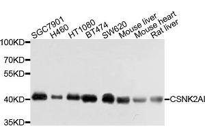 Western blot analysis of extracts of various cells, using CSNK2A1 antibody. (CSNK2A1/CK II alpha 抗体)
